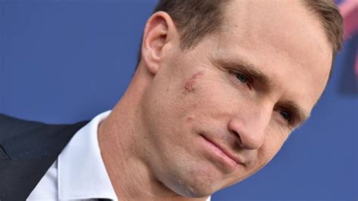 Has Drew Brees Done Face Surgery Or Is that A Mole Or Birthmark? – Details Explored