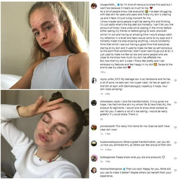 Imogen King Age, Wiki, Biography, Height, Instagram, Boyfriend, Net Worth